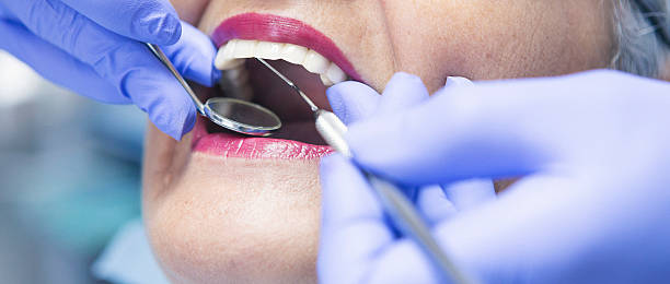 Best Emergency Dental Care for Broken or Chipped Teeth in Libby, MT